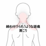 『後頭部の締め付けられるような頭痛と首が動かしづらい肩こり 登別室蘭すのさき鍼灸整骨院 症例報告』の画像