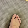 【悲報】ワイ、指がうっ血（※画像あり）