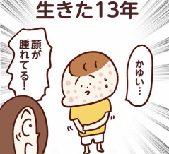 食物アレルギーと生きた13年【4話】