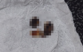 X民「耳かき使ってたらギネス級の耳クソ出てきてエグい。これ鼓膜じゃないよね？見たい人おる？」→ガチの衝撃画像が投稿されるｗｗｗｗｗｗｗｗｗ