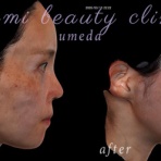 ～Dr.Fumiの美容Blog～