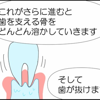 歯周病菌と戦う①