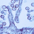 ハンタウイルスPCR検査の配列がヒトのDNAと繰り返し一致