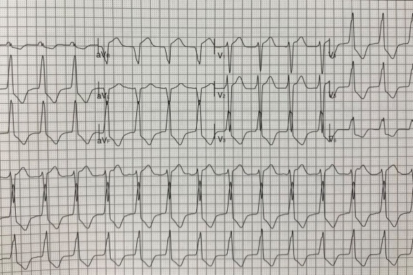 心電図の部屋 年06月