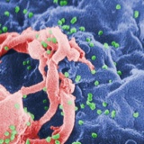 【原因不明】ロシアの主要なウイルス研究所が爆発　HIV、エボラ、炭疽菌、天然痘など貯蔵