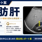 【1記事3分】超音波検査士けんしんのエコーノート