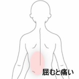『座位で悪化する腰背部の痛みと制限 　登別室蘭すのさき鍼灸整骨院　症例報告』の画像