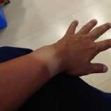 『ヒリヒリ』の画像