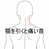 『急激なターンで首を痛め、顎を引くと右首がズキッと痛む 登別室蘭すのさき鍼灸整骨院 症例報告』の画像