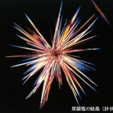 【生活習慣を改めたくなる話】　痛風になってしまった・・・