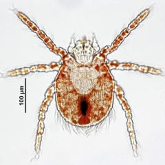 ダニが媒介する感染症　SFTS・ツツガムシ病・回帰熱
