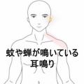 静かな環境で増悪する左耳の耳鳴りと入眠困難　 登別室蘭すのさき鍼灸整骨院　症例報告