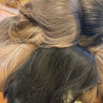 私が体験した抗がん剤の副作用の覚書と対策