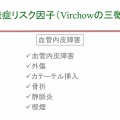 深部静脈血栓症について