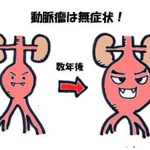 下肢静脈瘤を のり でくっつけて直すって本当ですか 脳筋系 心臓血管外科医の健康コラム