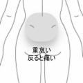 反る動作で悪化する運動後の腰の重だるさ　登別室蘭すのさき鍼灸整骨院　症例報告