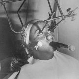 まるで拷問…痛々しくて恐ろしい昔の医療機器たち【画像】