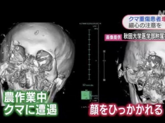 【動画】クマと遭遇した時の『最初の一撃』、とんでもない威力