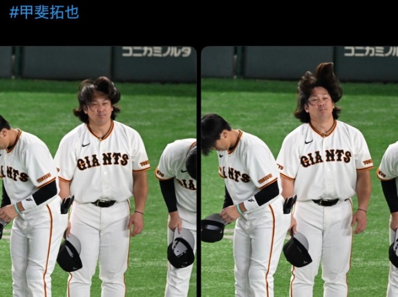 【画像】甲斐拓也の毛量、限界突破ｗｗｗｗｗｗｗｗｗｗｗ