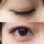 【悲報】ワイ一重、美容外科で二重整形を断られるｗｗｗｗ