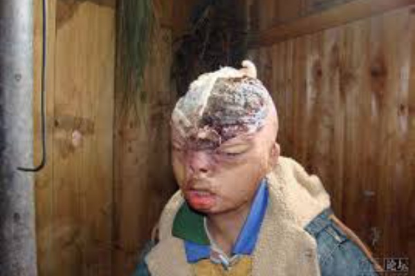 ｇｒｏｃｋｓ グロ画像