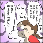 帯状疱疹になりました⑤