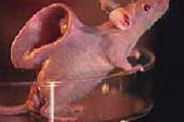 再生医療 左耳を失った米女性兵士 前腕で育てた耳の移植手術に成功 05 11 博士ニートまとめ