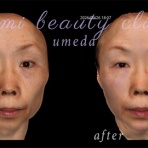 ～Dr.Fumiの美容Blog～