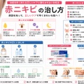 赤ニキビの治し方｜炎症を早く抑える正しいケアと悪化させない対処法