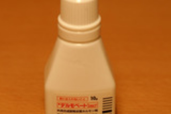 実際に円形脱毛症 男性型脱毛症と闘っている男の話