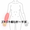 検品作業で生じた右肘から手首のズキズキ痛と小指の痺れ 登別室蘭すのさき鍼灸整骨院　症例報告