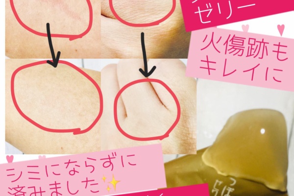 好きなことだけする生活日記 コラーゲン プラセンタ 美容サプリメント