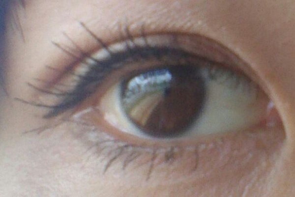 アイプチさよなら