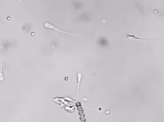【悲報】研究者「自力で泳げない精子でも受精させることに成功したぞ！」　女性「…」
