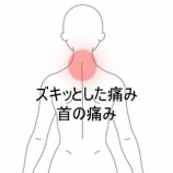 『美容室での洗髪後に生じた左後頚部のズキッとした痛みと動作制限 　登別室蘭すのさき鍼灸整骨院　症例報告』の画像