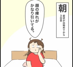 帯状疱疹になりました⑥（完）