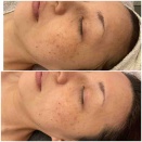 これぞ白玉水光！！！