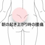 『買い物後に発症した朝型の腰痛　登別室蘭すのさき鍼灸整骨院　症例報告』の画像