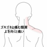 『静止時に現れる右肩上部のズキズキ痛 　登別室蘭すのさき鍼灸整骨院　症例報告』の画像
