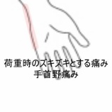 『起き上がる動作や握る動作で痛む左手首から指先の痛み　登別室蘭すのさき鍼灸整骨院　症例報告　』の画像
