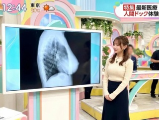 【画像】めちゃくちゃ猫背な女子アナ見つかる