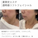夏限定エステ