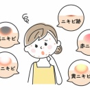 18歳姪っ子のニキビ改善に、効いたって!!