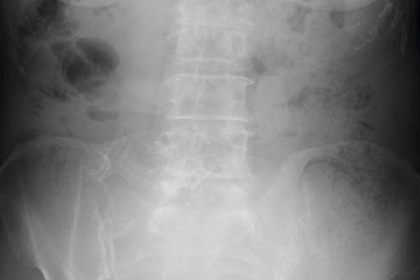 こどもの病気 おとなの病気 13年08月