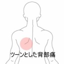 ストレッチ動作で増強する左背部のツーンとした痛み 登別室蘭すのさき鍼灸整骨院　症例報告