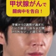 【韓国】『チャン・グンソク』甲状腺がん闘病を経て財団設立の考えを明かす