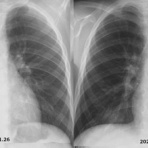 こどもの病気・おとなの病気