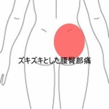 『起床時から始まった右腰のズキズキ痛と日常動作の制限　登別室蘭すのさき鍼灸整骨院　症例報告』の画像