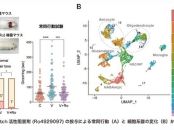 【衝撃】東海大学、ASD（アスペルガー）の原因『ノッチシグナル』の存在を特定。根本治療の方法を発明か。