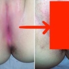 ◆【ぽっかりマンコ動画有り】黒人♂と1回SEXした後の白人少女のマンコがコチラｗｗｗ 衝撃のビフォーアフターｗｗｗ